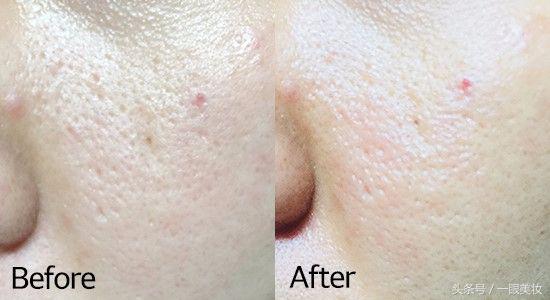 韩国drjart面膜紫色,韩国drjart面膜