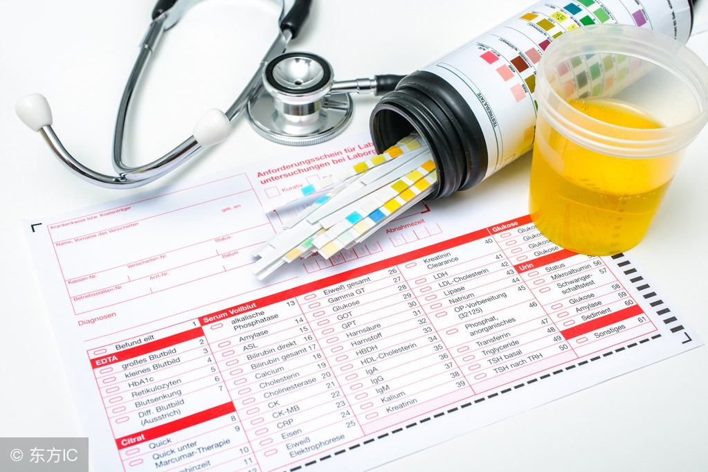 尿酸高引起痛风别慌,痛风发作尿酸580还用再查尿酸吗