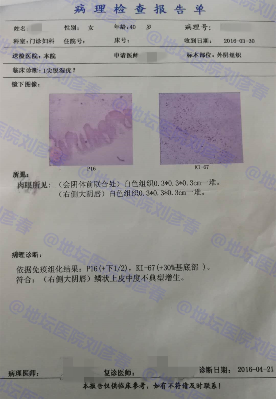 宫颈切除hpv持续感染怎么办,宫颈病变切除后hpv16阳性