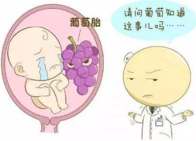 孕早期出血就是宫外孕吗,大量出血一定是流产吗