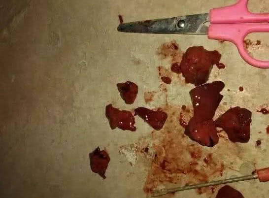 夜钓黄蜂鱼和土鲶一大盆，被鱼鳍割破了手