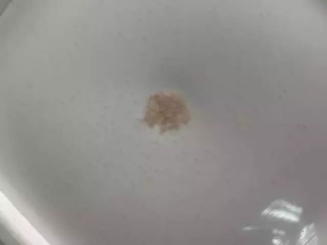 螨虫走开！中疾控检测100%有效，家有小宝、消除过敏源必备