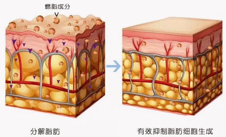 半个娱乐圈撞*裤内**？谁叫它提臀细腰又瘦腿