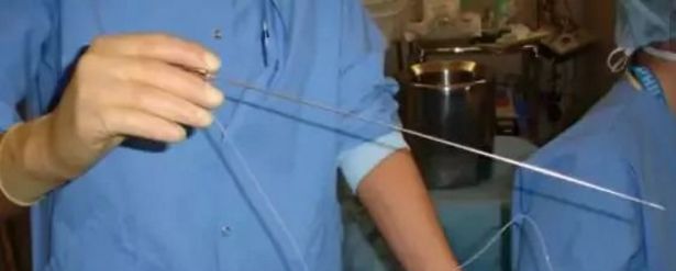 21颗卵卖10000元，17岁少女险丢命！女人一生多少卵子？长点心吧