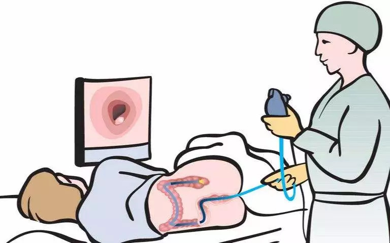 肠镜可怕,肠镜很恐怖怎么办