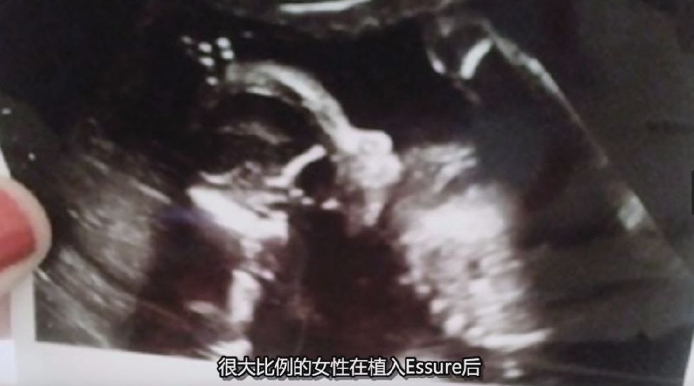 “*交性**意味着死亡”医疗行业背后的真相让人毛骨悚然