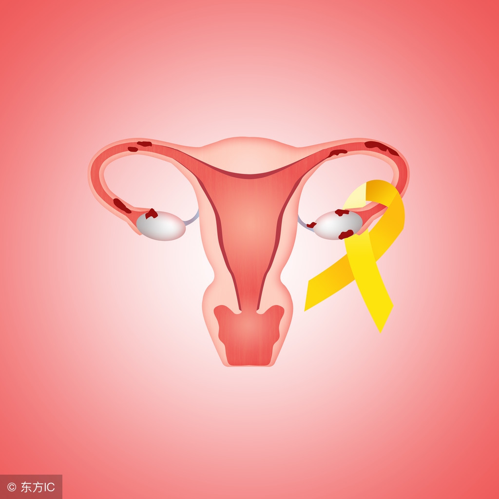 流产后引发子宫内膜炎保健工作怎么做