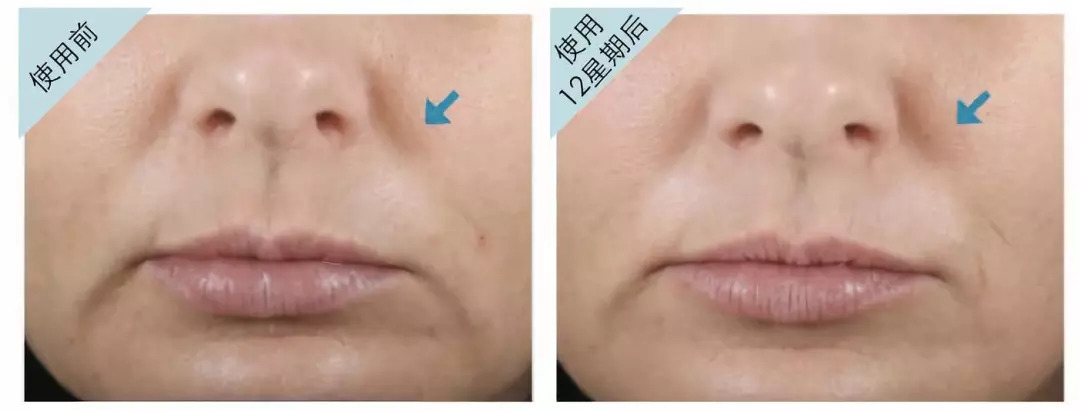 测评护肤品专业,测评最好的护肤套装