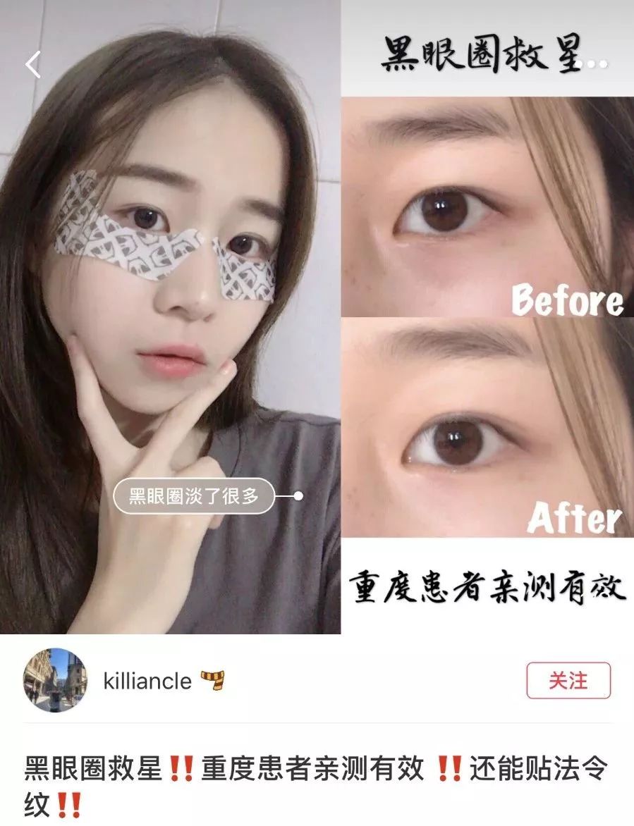 陆毅贝儿眼膜,陆毅用的眼膜