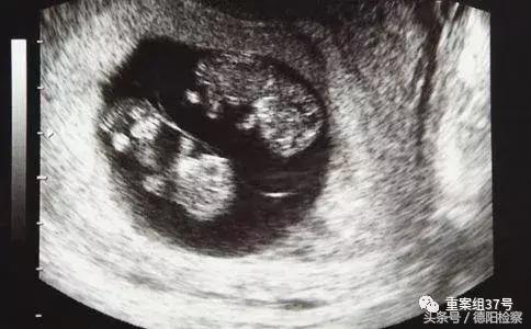 国内最大“寄血验子”案背后的入刑之争｜参与孕妇超5万，有人鉴定性别后引产