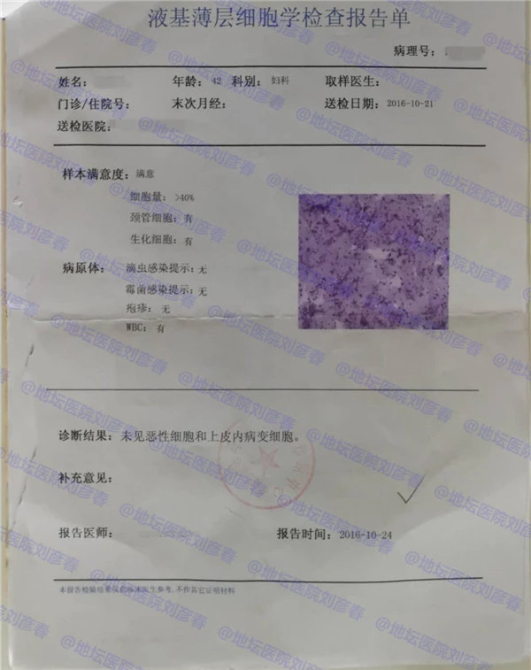 hpv持续感染多久会癌前病变,hpv持续感染但是tct正常