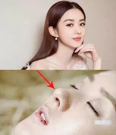 磨皮神器隐形毛孔真实效果,粗毛孔去黑头测评