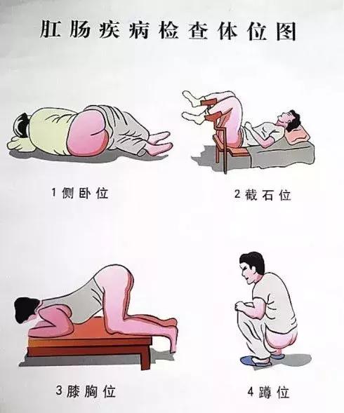 美国看痔疮手术,在美国看癌症和在中国看病的区别