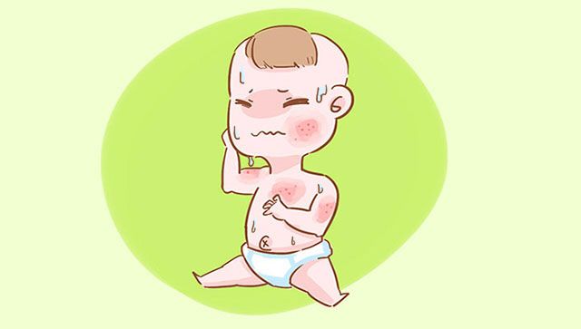 尿布疹和湿疹,宝宝湿疹和尿布疹各种最佳图片
