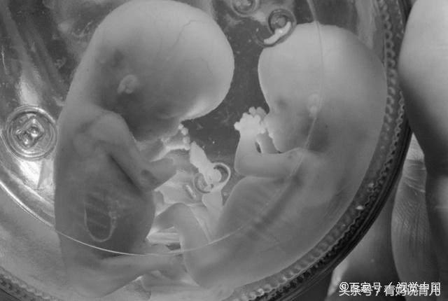 孕期孕妈身体有这3种表现，很可能是动了“胎气”，要及时就医