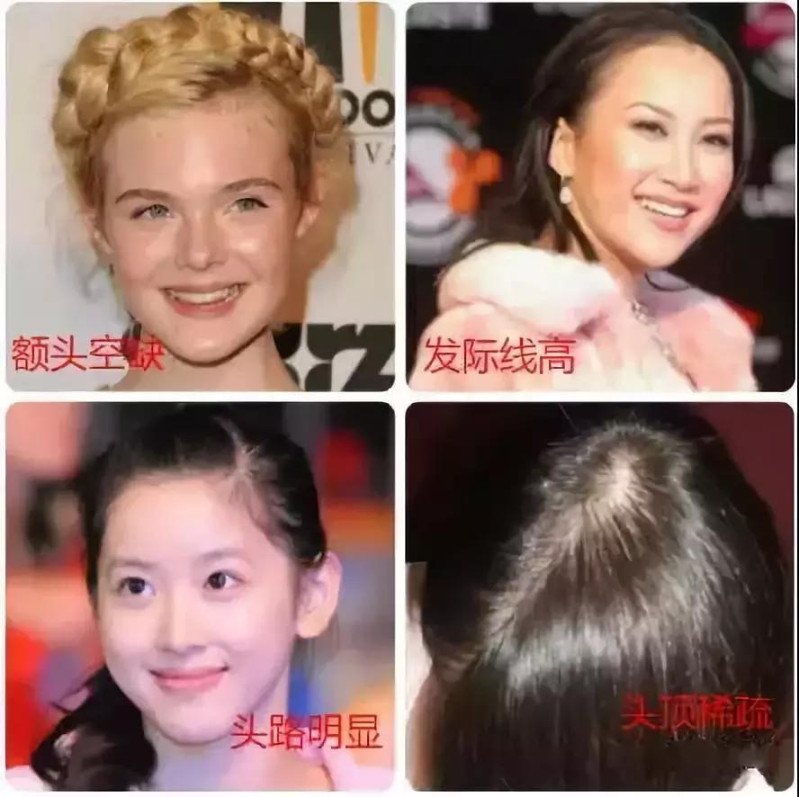 头发变薄用什么梳子,有什么原因会让头发变薄