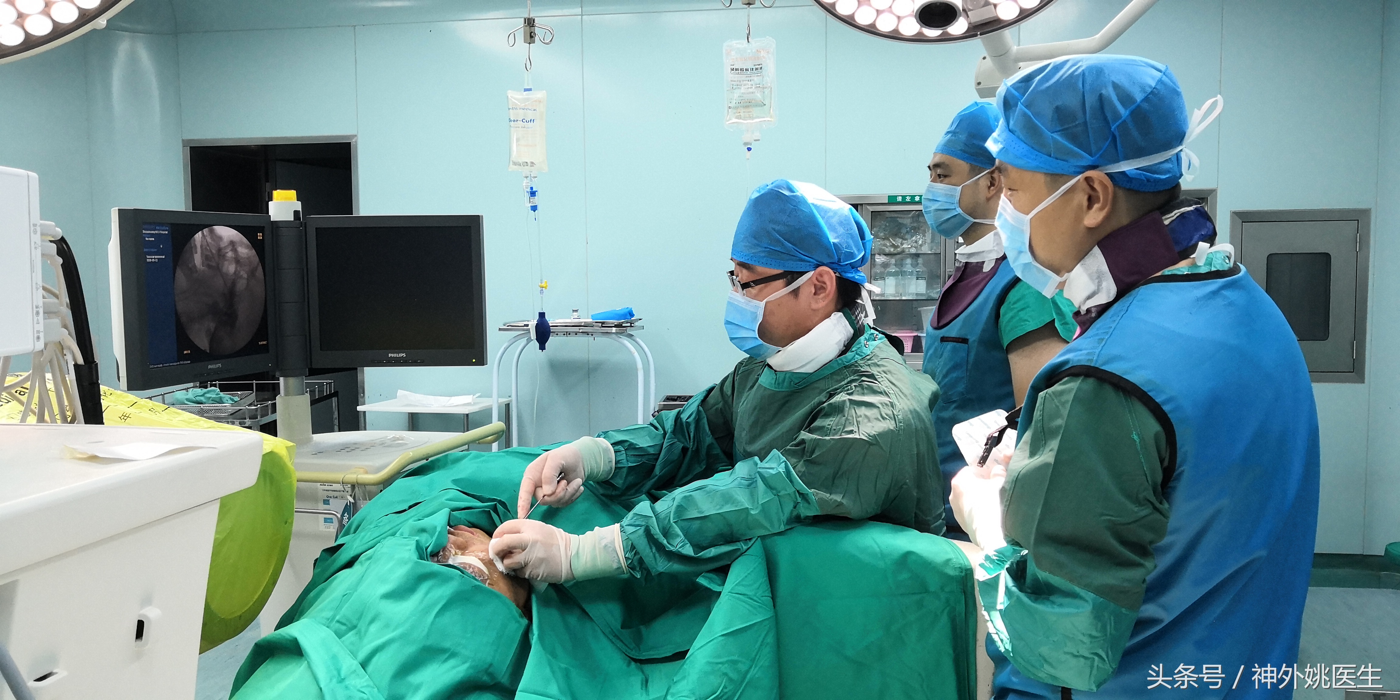 经皮穿刺半月神经节微球囊压迫术,经皮穿刺微球囊压迫术是几级手术