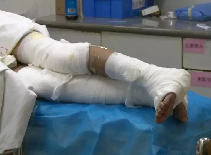 厦门发生闪爆事件,厦门闪爆事故的视频