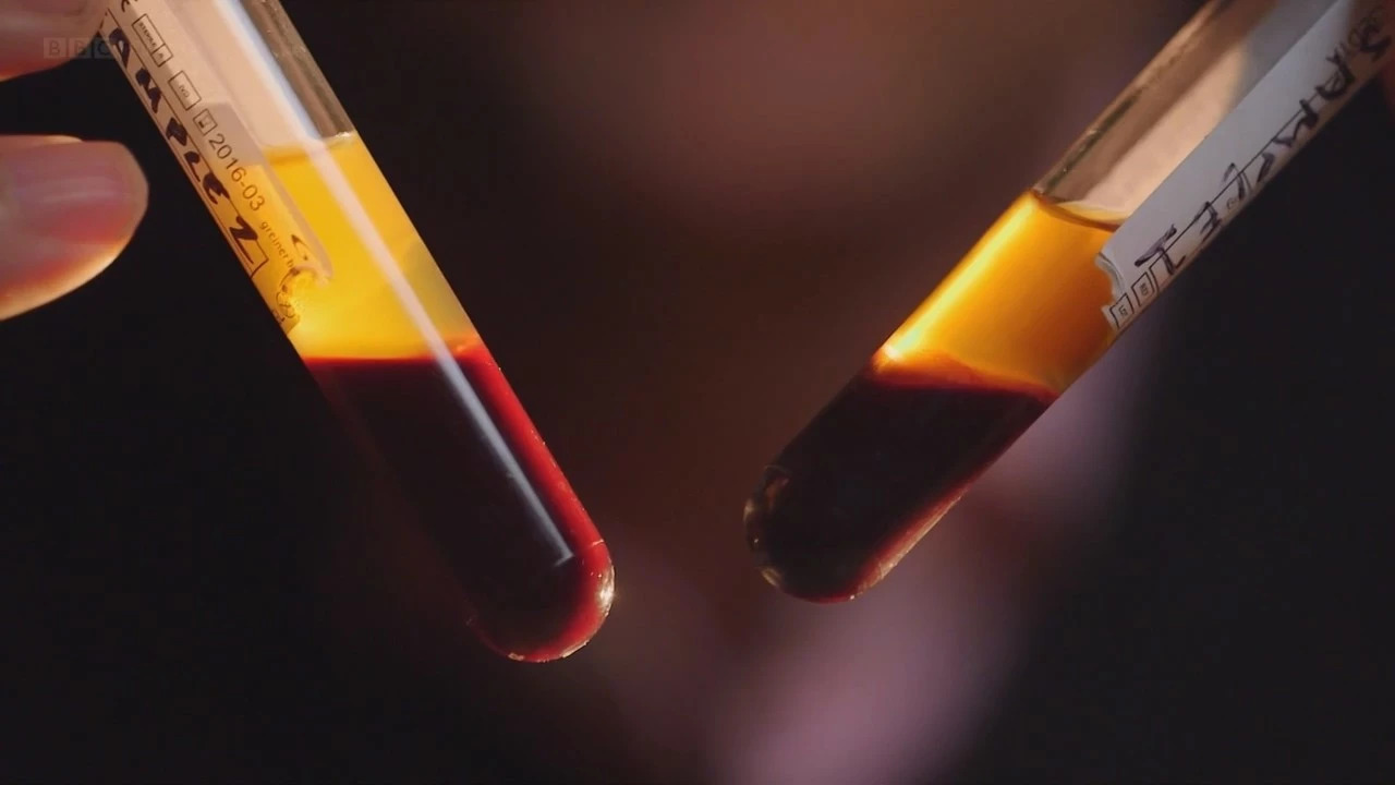 很血腥猎奇的三部纪录片,比较血腥的纪录片