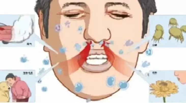 推荐孩子用的鼻炎喷雾,儿童好用的鼻炎喷剂