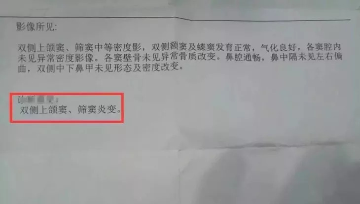 推荐孩子用的鼻炎喷雾,儿童好用的鼻炎喷剂