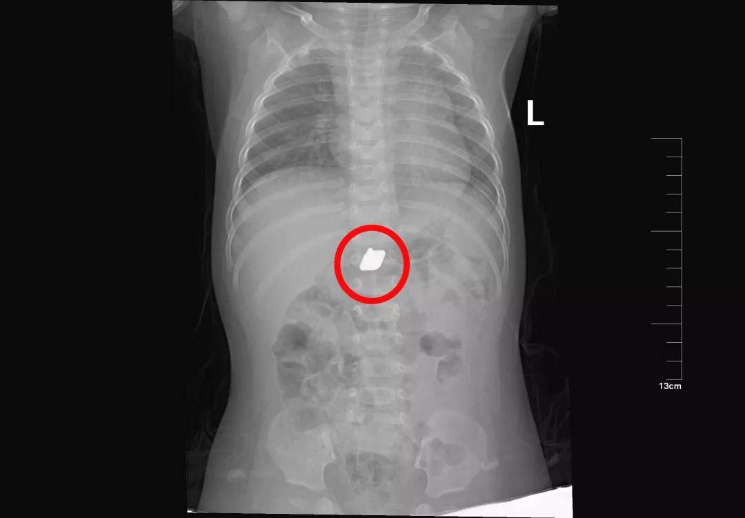 一些让人毛骨悚然拍到的照片,六个令人毛骨悚然的影像