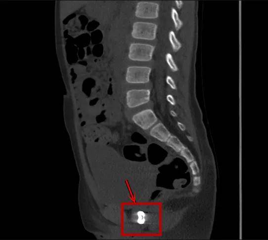 一些让人毛骨悚然拍到的照片,六个令人毛骨悚然的影像