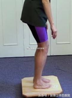 膝关节滑膜皱襞综合征锻炼,膝关节滑膜皱襞综合征怎么治