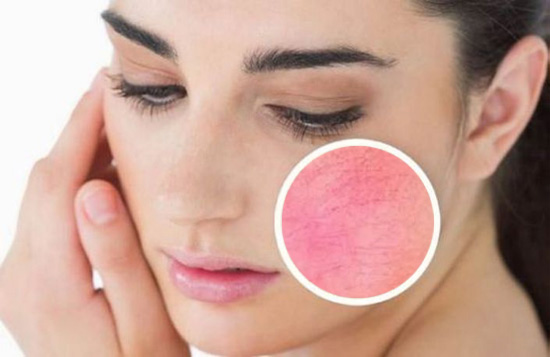 皮肤紧致怎么用英语表达,用英文表达皮肤状态