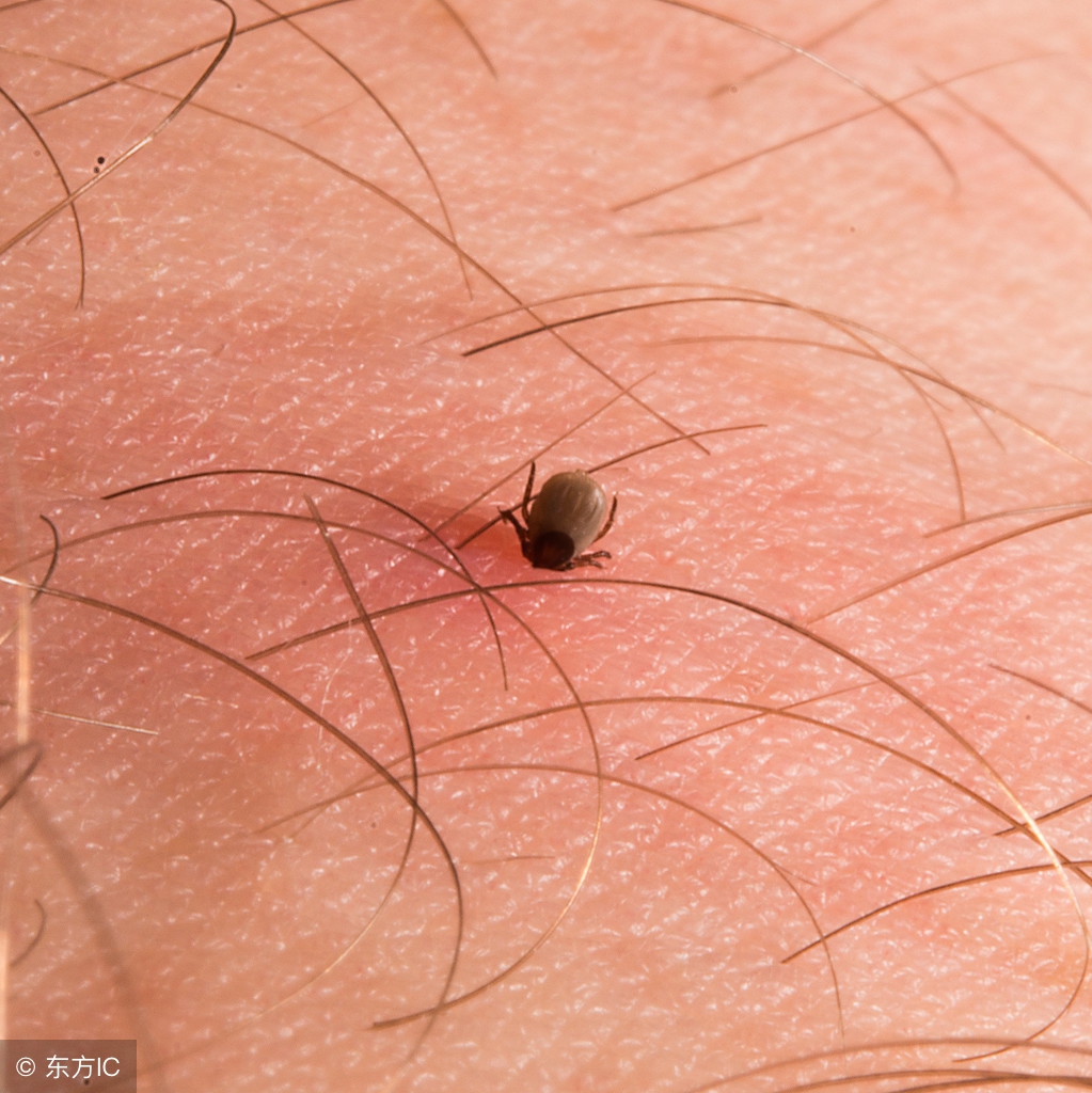 螨虫过敏儿童适合睡什么样的床垫,螨虫过敏教你一招去除螨虫