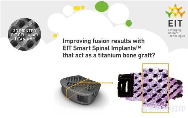 骨科植入物工厂,骨科植入物医疗器械公司