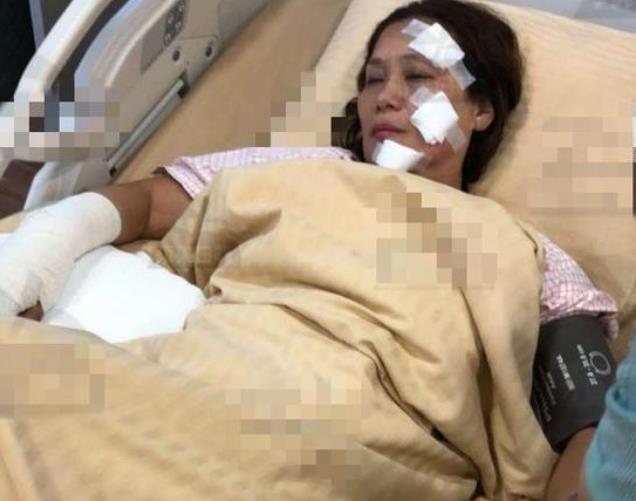 selina烧伤前照片,selina烧伤事件图片