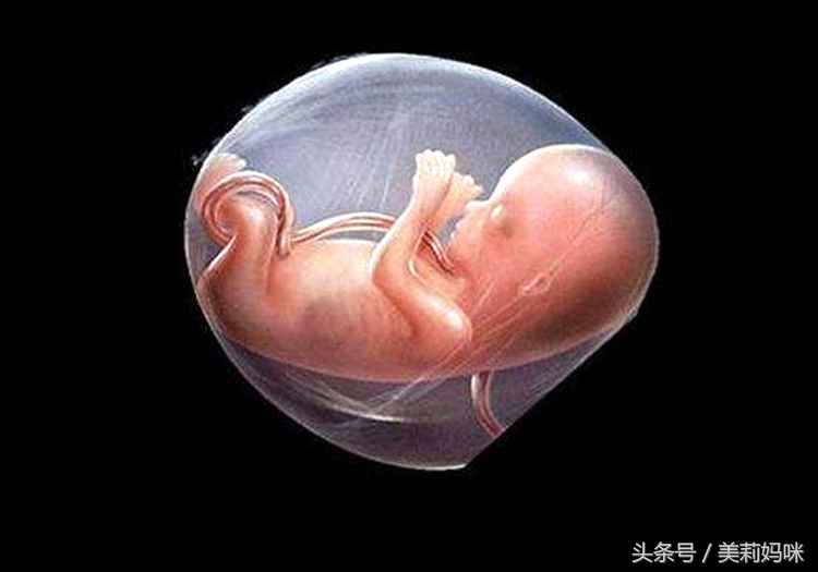 有过胎停育的孕妇怎么办,当孕妇出现胎膜早破时怎么护理