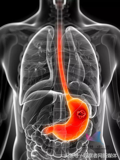 何止长胖牙黄，喝可乐还会……脖子变黑！可怕的后果标题写不下