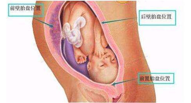怀孕5个多月的宝宝应该教什么,怀孕五个月注意什么胎教