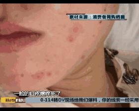 被推爆的网红面膜到底值不值得买,曝光会烂脸的面膜