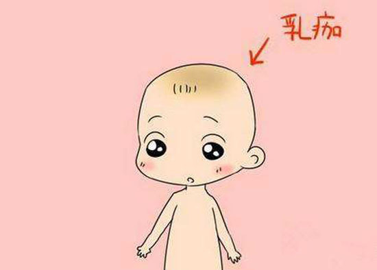 宝宝胎垢去掉还会长怎么办,宝宝的胎脂要去除吗