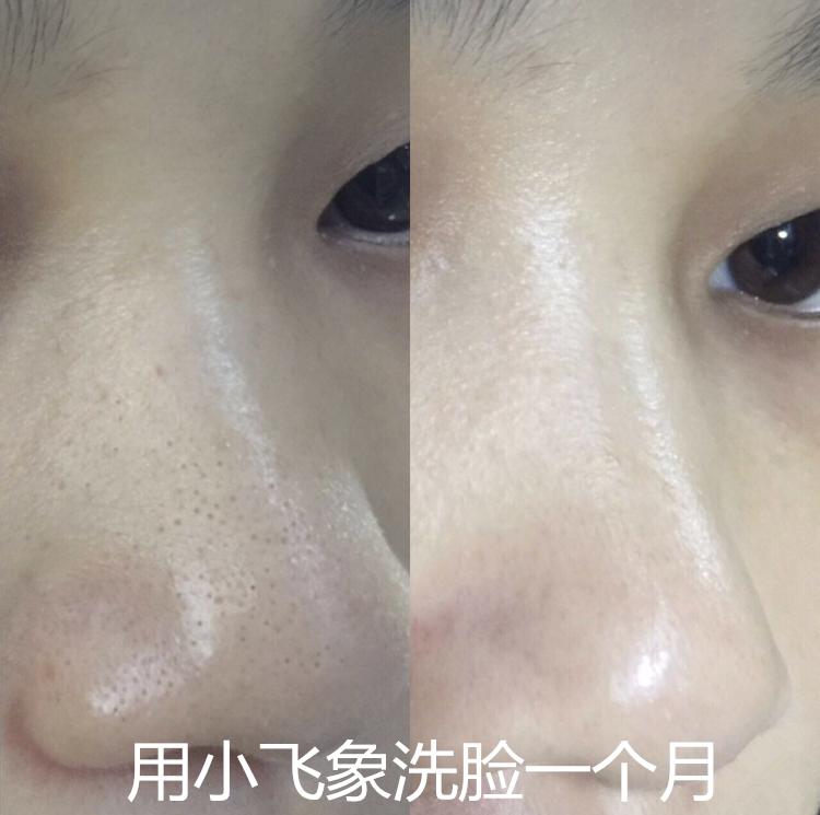 真的火了很多年的luna洁面仪,luna洁面仪韩国版