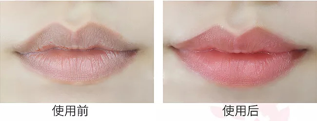 嘴唇干裂？世界最昂贵“液体钻石”，恢复水润，告别唇部细纹！