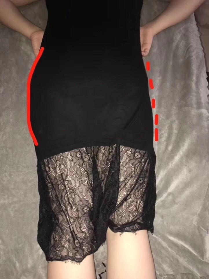 产后腰围能自动恢复吗,做了产后修复腰围少了3cm