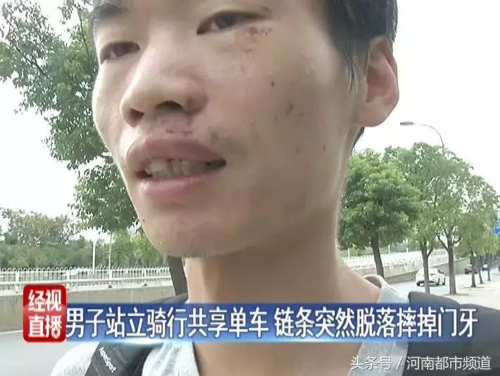骑共享单车摔掉门牙,男子骑共享单车被撞