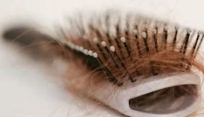 总是掉头发什么原因引起的,什么问题导致你掉头发