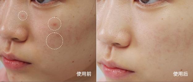 7秒卖1瓶!这款日本爆火单品,3分钟让大干皮变身“水宝宝”!