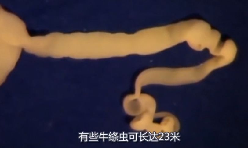 吃活物有寄生虫,吃活的虫子身体里有寄生虫