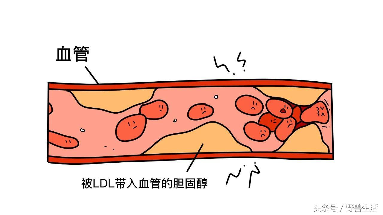 大蒜片一天吃多少最好,大蒜的保健吃法和注意点