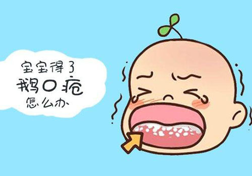 鹅口疮疾病了解,你了解小儿百日咳吗