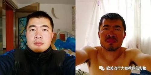 身体晒伤后快速修复的十大妙招,孩子被太阳晒伤皮肤发红急救方法