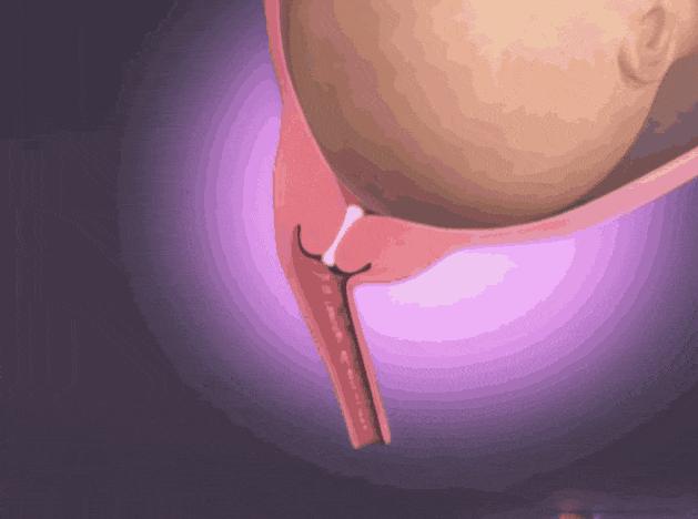 顺产需要开几指才可以用力,顺产开十指要侧切吗