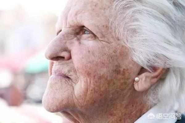 祛老年斑消除最快最有效方法,经常按摩哪里可以消除老年斑