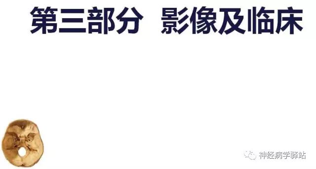 舌下神经和舌咽神经的解剖图,颊神经舌神经解剖图